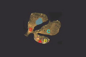 iVP{X}bv